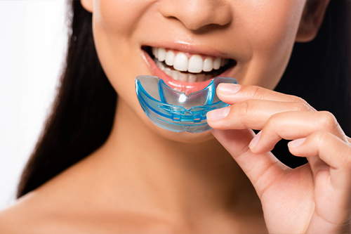 Woman placing a blue nightguard over her teeth