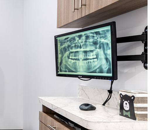 X-ray of teeth on a computer monitor