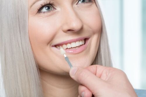 Cosmetic dentist holding a shade guide to a smiling patient