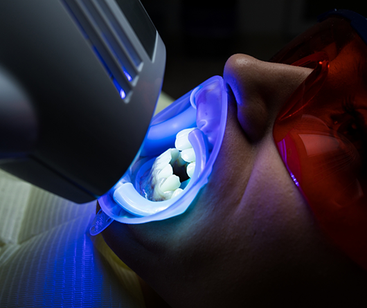 Dental patient getting teeth whitening with a UV light