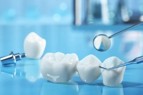 Dental bridge and dental implant on table