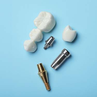 Diagram of the various parts of a dental implant