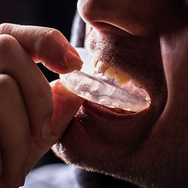 Person placing an athletic mouthguard over their teeth