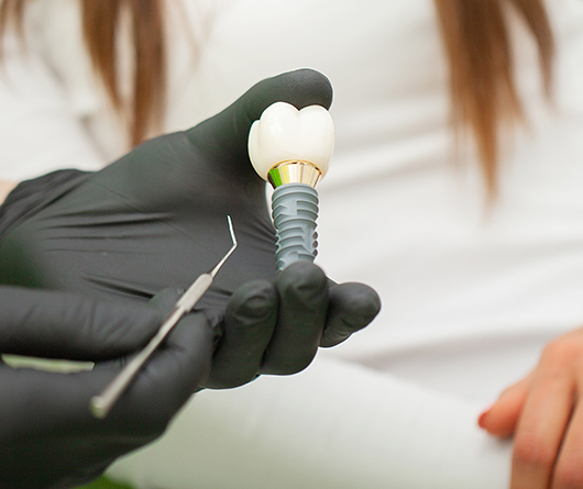 Dentist showing a dental implant to a patient