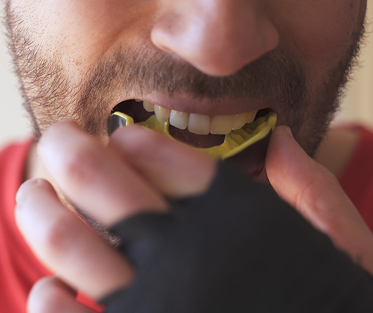 Athlete placing a mouthguard over his teeth