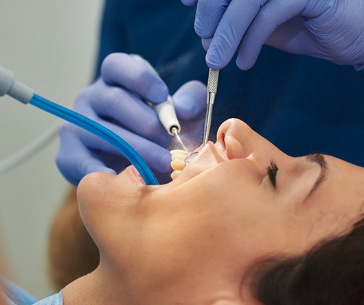 Woman undergoing a dental checkup