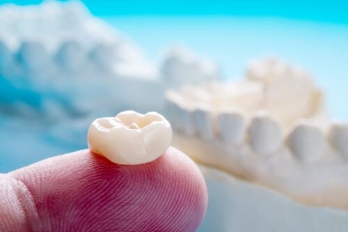 White dental crown resting on a finger