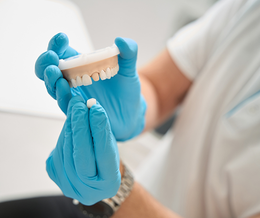 Dentist placing a crown over a model of a tooth
