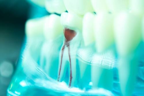 Model of a tooth showing the root canal inside of it