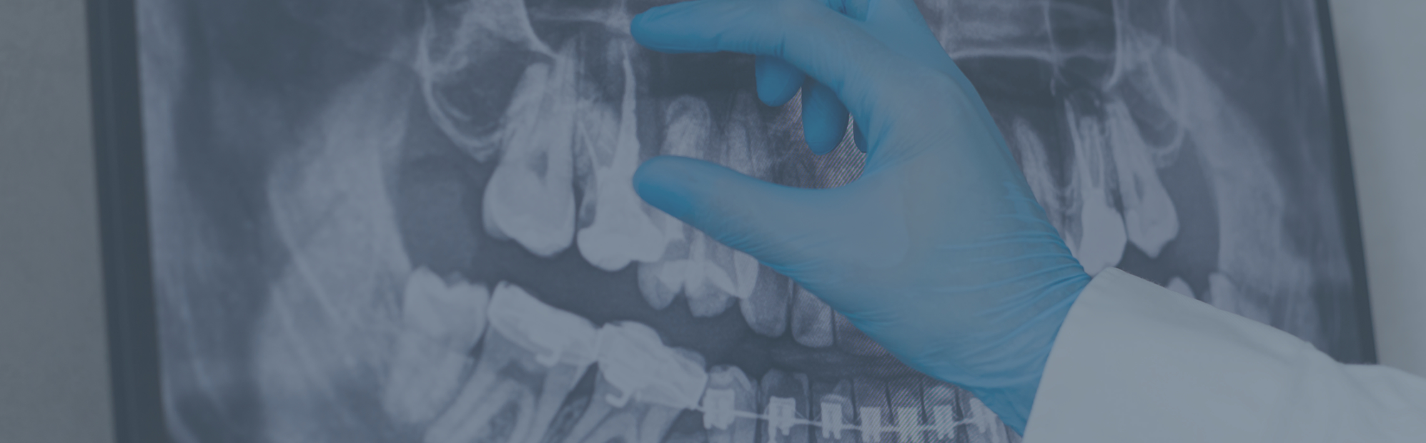 Dentist gesturing to a tooth on a patient's x-ray