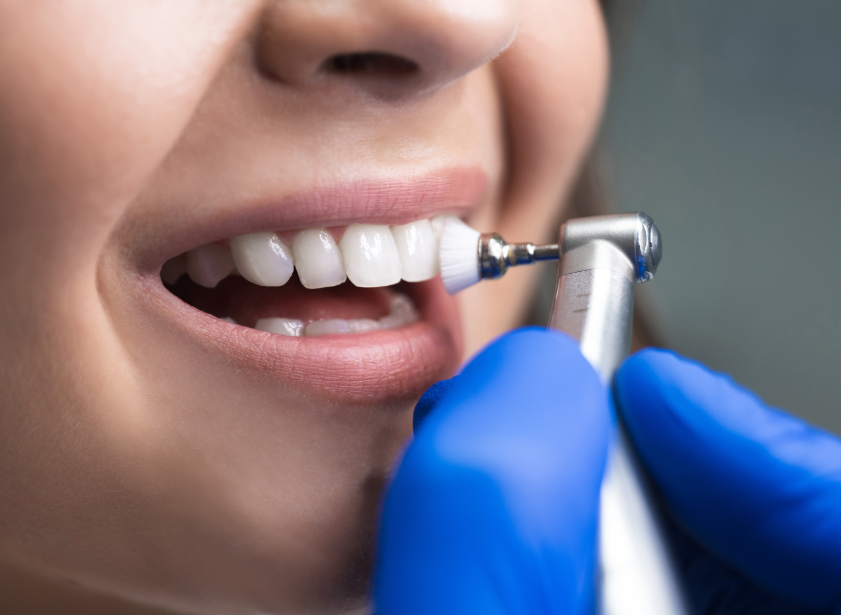 Close up of woman's teeth being cleaned